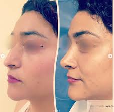 Dra. Tania Avilés Cirugía Plástica y Reconstructiva en Chetumal