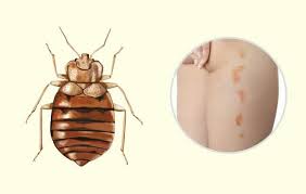 10 Gewohnliche Stiche Die Jeder Kennen Musste Moctopus Bettwanzen Stiche Gesundheit Und Wellness Und Kinder Gesundheit