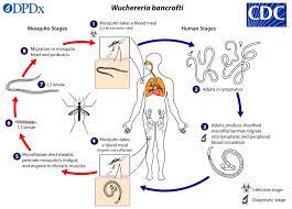 CDC - DPDx - Lymphatic Filariasis