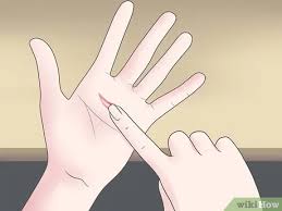 Diese steristrips dienen zum zusammenhalten der wunde und sollten erst nach einer woche entfernt werden (meist fallen sie vorher selber ab). Steri Strips Aufkleben 14 Schritte Mit Bildern Wikihow