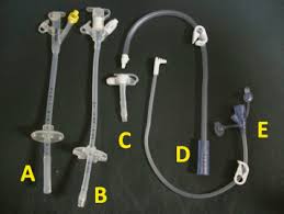 Percutaneous Endoscopic Gastrostomy Tube Replacement