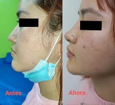 Tratamientos faciales y corporales