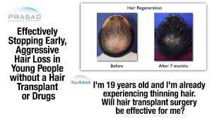 The cause of the problem can also play a key role on the prognosis and outlook of whether or not the hair follicles will grow back normally. Why Hair Thinning At 19 Signals Rapid Hair Loss And A Treatment To Stop Hair Loss Progression Youtube