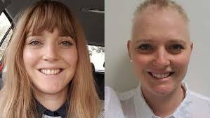 Alopecia: What it's like for a woman to lose her hair