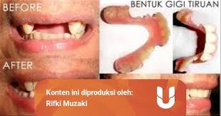 Maybe you would like to learn more about one of these? Ahli Gigi Jabodetabek Terima Panggilan Termurah Di Jakarta Bogor Depok Tangerang Bekasi Kumparan Com
