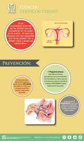 Prevencion Del Cancer Cervico Uterino Imss Salud Cancer Cervicouterino Salud
