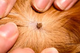 Allergic reactions can take up to 24 hours to occur. What Do Fleas Look Like Visual Guide Pestseek