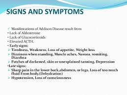 Addisons 10 638 Jpg 638 479 Addisons Disease Muscle Aches Tiredness