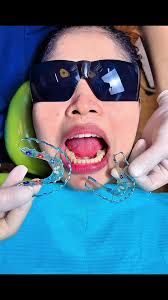 #chantlaclinicdental #foryoupage #viral #khmerdentist #foryou #foryou  #dentist #fy #fyp