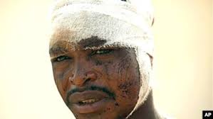 Kungiyar Rajin Kare Hakkin Dan Adam Ta Ce Rikicin Da Ya Biyo Bayan Zaben  Nijeriya Ya Hallaka Mutane 800