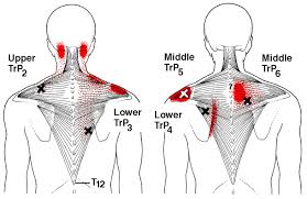 Pin On Natural Pain Relief