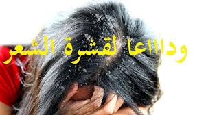 وصفه رائعه لازالة قشرة الشعر نهائيا فاسرع وقت وجربيها انتى Youtube