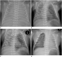 Many congenital and acquired diseases that the radiologist is faced with in neonatology are unknown in the imaging of. Jksr Journal Of The Korean Society Of Radiology