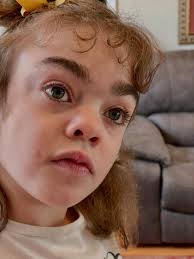 Sadie is taking a sick day to recover from her procedure. She is doing very  well. Thank you for all the love! 🙏