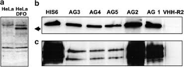 Order monoclonal and polyclonal insulin antibodies for many applications. Identification By Phage Display Of Single Domain Antibody Fragments Specific For The Odd Domain In Hypoxia Inducible Factor 1alpha Laboratory Investigation