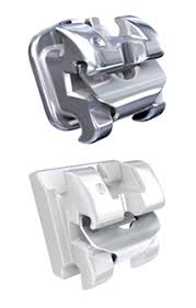 Self Ligating Braces For High Tech Ortho Choose from over a million free vectors, clipart graphics, vector art images, design templates, and illustrations created by artists worldwide! self ligating braces for high tech ortho