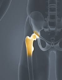 It often happens in people under age 20. Where S Your Pain Hip Kansas Spine Specialty Hospital