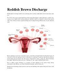 Is it normal to have smelly brown discharge every after period? Reddish Brown Discharge