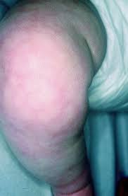 Image result for Harlequin Color Change