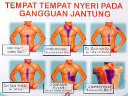Namun, sakit dada tidak semestinya berkaitan dengan serangan penyakit jantung. Penyakit Tapi Bukan Penyakit Bagian 10 Nyeri Dada Komunitas Pecinta Pengobatan Alami