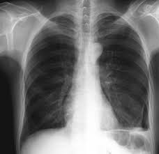 We did not find results for: Srim Societatea De Radiologie Si Imagistica Din Romania