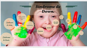 Los niños con síndrome de down necesitan una atención médica especial dependiendo de ciertos problemas de salud. Sindrome De Down By Lorena Aguila Marquez