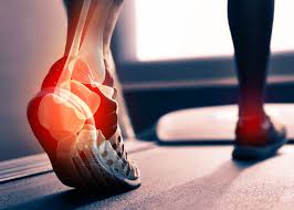 This occurs at the bottom of the heel where the tendon attaches to the heel this is a specific type of massage involving friction being applied transversely over the site of injury. Achilles Tendinitis And Pronation