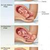 I have also had a client personally that was 75% effaced for some time before she ever went in to labor, though she had hoped she would at the time and she too was 3cm for which she will decare forever. 1