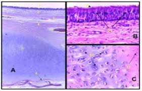 Snowmobile trail stream vt dept. Figure 2 From Morphological Histological And Histochemical Study Of Trachea Of One Hump Camel Camelus Dromedaries In South Of Iraq Semantic Scholar