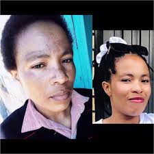 Is no too late for the glow look before and after