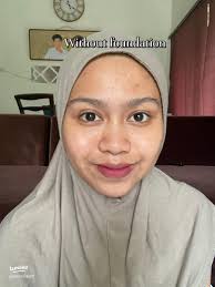 Testimoni Foundation Bella Park: Kelebihan dan Manfaatnya