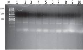 Pure free download manager, accelerator, and organizer that will increase download speeds up to 10 times faster. Prevalence Of Methicillin Resistant Meca Gene And Heat Resistant Staphylococcus Aureus Strains In Pasteurized Camel Milk Journal Of Dairy Science
