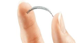 Conoce más del implante anticonceptivo subdérmico. Essure Los Riesgos Del Implante Anticonceptivo Mas Seguro Del Mundo Bbc News Mundo