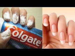 Hongos En Las Uñas De Las Manos Como Eliminarlos Como Eliminar Los Hongos De Las Unas De Los Pies Y Manos Con Remedios Caseros Onicomicosis Eliminar Hongos De Las Unas Trucos De Belleza Crecimiento De Unas