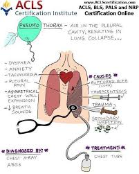 Pin On Nclex Nursing Study Stuff