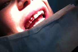 Detras De Mi Cara Hinchada Pude Ver Que Seis De Mis Dientes Frontales Ya No Estaban La Pesadilla De Mi Sonrisa Perfecta Bbc News Mundo