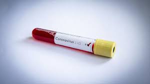 You can use filters and sorting to find. Uganda Confirms First Case Of Covid 19