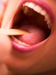 Share on facebook share on twitter share on pinterest. Tonsil Stone Removal Videos Are Taking Over The Internet Allure