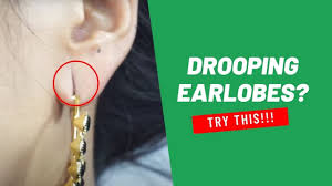 One, take the jewellery out. Proven How To Reduce Ear Hole Size Naturally At Home Top10 Natural Tips