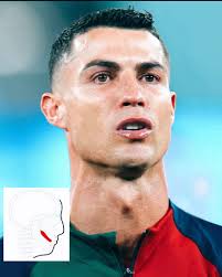 Kid Mewing at Real Madrid Game