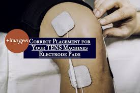 Correct Placement For Your Tens Machines Electrode Pads