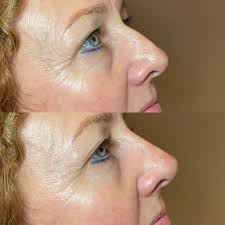 Lucy Clare Aesthetics