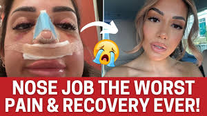 NOSE JOB SURGERY, THE WORST PAIN AND RECOVERY EVER!