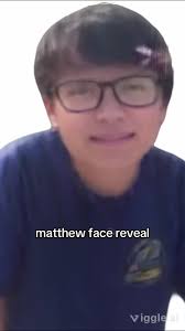 Matthew Beam Face Reveal
