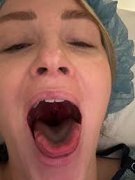 Girls I can't make it today I have tonsillitis again and it hurts to move  my head Wish you the best of luck!