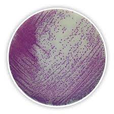 Colorex™ salmonella allows for simultaneous growth, detection and chromogenic differentiation of. Salmonella Chromogenic Agar 100 G Chromogenic Media Anhydrous Nutrient Media For Microbiology Microbiology Life Science Carl Roth International