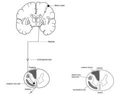 Image result for Neurologic Lesion Localization