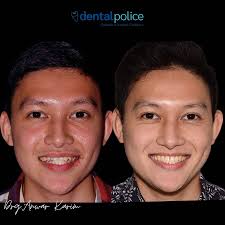 Dr. Anwar Yao Karim (@dentalpolice) • Foto dan video Instagram