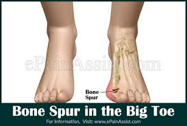 Pin On Joint Pain