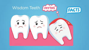 Mýty a fakty o domácich tipoch na bolesť zubov: Čomu veriť a čomu nie?